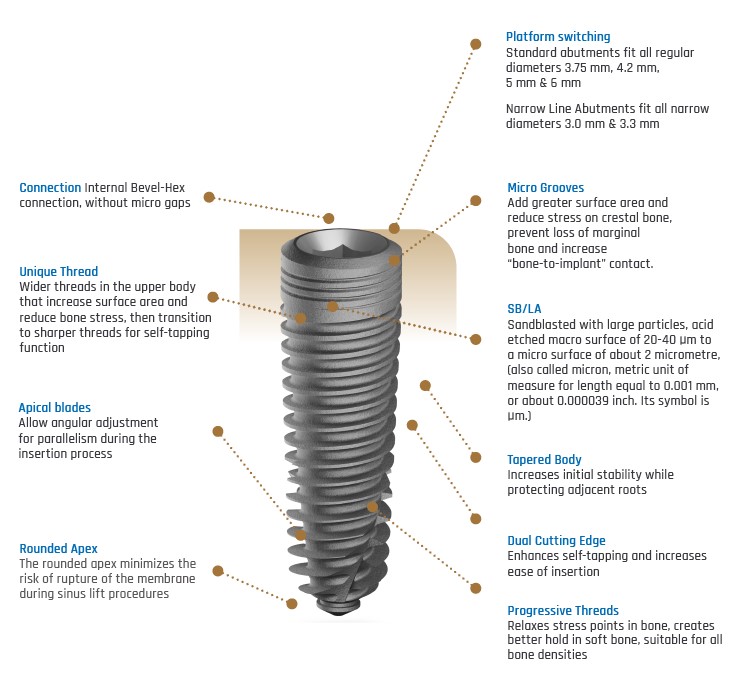 The Key Implant Features